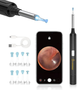 VITCOCO Ear Wax Removal, Wireless Ear Cleaner with 1296P HD Ear Camera and 3.9mm Ear Otoscope, Earwax Removal Tool with 6 LED Lights, Kids Adults Ear Cleaning Endoscope for iPhone Android Phones